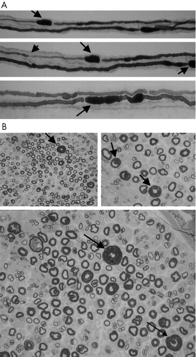 jnnp-2004-November-75-11-1629-F1.large